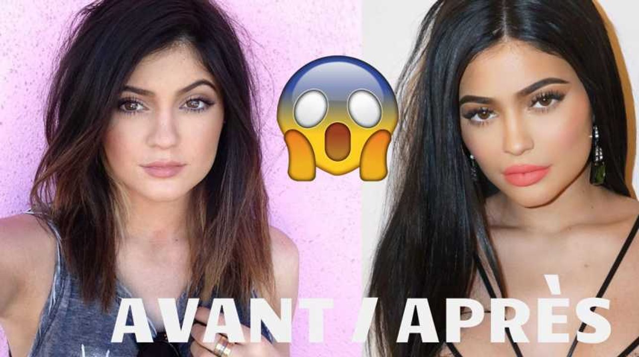 Avant / Après : Kylie Jenner, son incroyable transformation physique