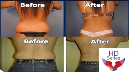 Mix 1 Tablespoon of Apple Cider Vinegar & Burn the Belly Fat Fast _ @ HD Series