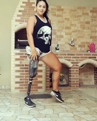 Danse d'une femme unijambiste avec une prothèse de jambe