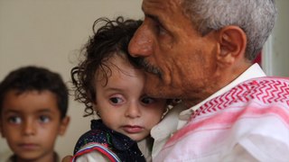 Cholera outbreak spreads in war-torn Yemen