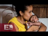 Registra Brasil más de 500 casos de microcefalia / Paola Barquet