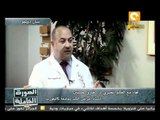 أمل مصري لمرضى فيروس الالتهاب الكبدي سي