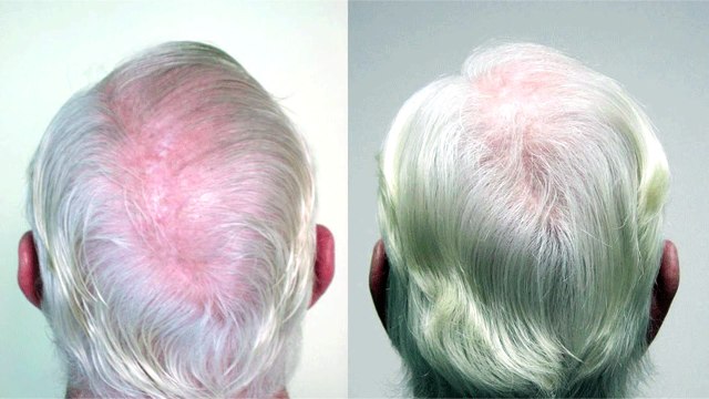 Ancient Hair Secrets – Natural Hair Growth Products