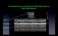 Ultrasound video 13-Critical-Care-Ultrasound-Vignettes-3