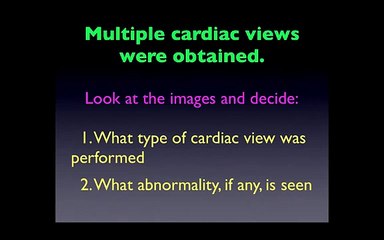 ULTRASOUND VIDEO 14-Critical-Care-Ultrasound-Vignettes-4