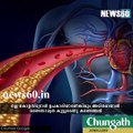 'Good' cholesterol not always good, study suggests