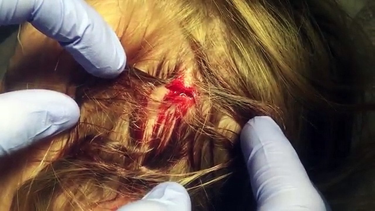 EMERGENCY STITCHES!