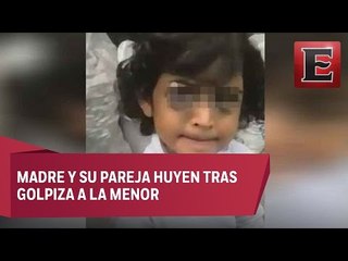 Buscan a niña golpeada por su padrastro en Iztapalapa