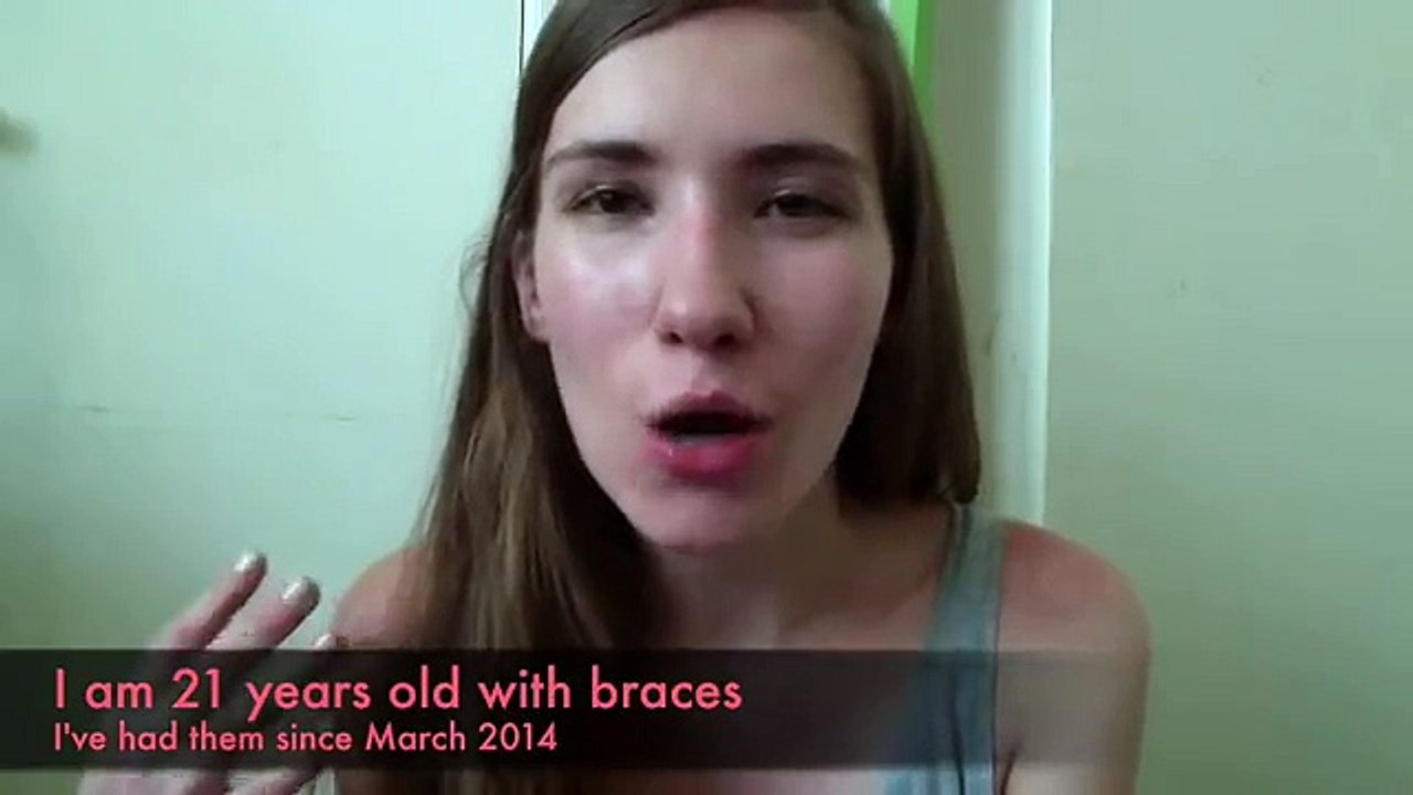 Surtidos apoyos Conde elásticos de para ligadura ortodoncia corbatas Easyinsmile dental 1040 color