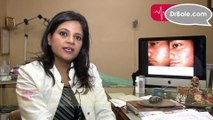 Precautions for Acne Dr Deepali Bhardwaj Skin & Hair Specialist_New Delhi_DrBole_com - YouTube (REPEAT)