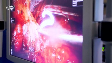 Digital Germany - The robots are coming (1) | DW English