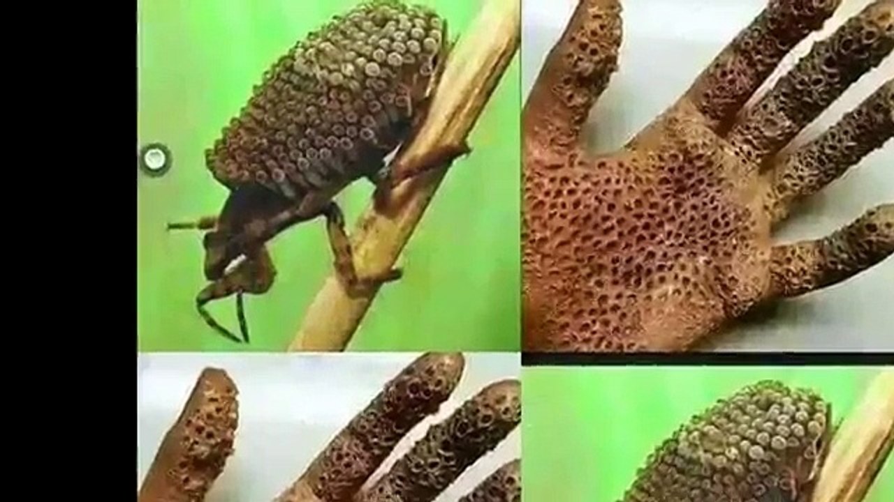 इस भयंकर बीमारी की सच्चाई जानकार चौक जायेंगे आप.......