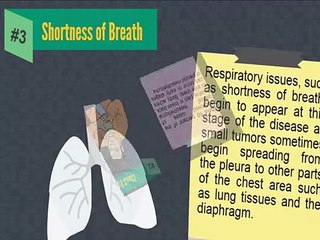5 symptoms of mesothelioma at early stage