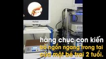 Sợ run người trước cảnh kiến làm tổ trong tai bé trai 2 tuổi