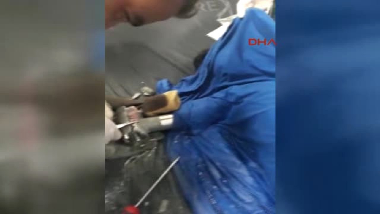 Mersin 2 Yaşındaki Çocuk Elini Kıyma Makinasına Kaptırdı - Ek