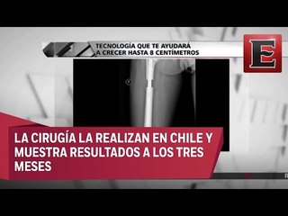 Tecnología ayuda a crecer hasta 8 centímetros