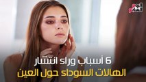 فيديو معلوماتى.. 6 أسباب وراء انتشار الهالات السوداء حول العين