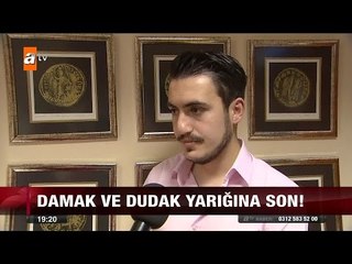 Damak ve dudak yarığına son - atv Ana Haber