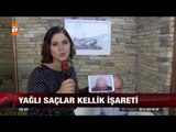 Saçı yağlı olanlar dikkat! - atv Ana Haber