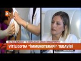 Vitiligo'da yeni tedavi yöntemi - atv Gün Ortası Bülteni