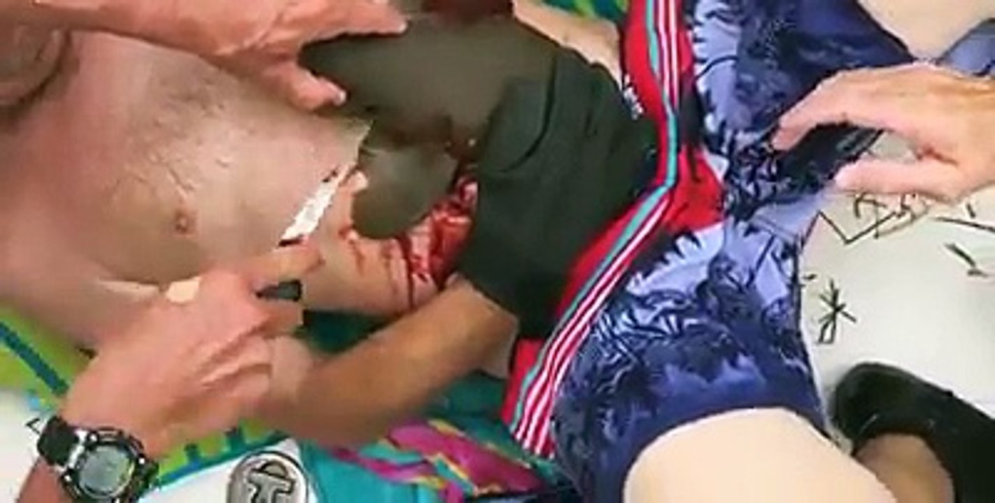 سمكة قرش تلتهم رجل خارج المياه