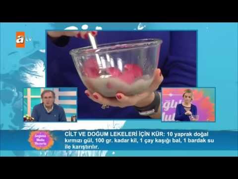 Cilt ve doğum lekeleri için kür - Sağlıklı Mutlu Huzurlu 70.Bölüm - atv