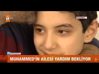 Küçük Muhammed'in kanserle savaşı - atv Gün Ortası Bülteni