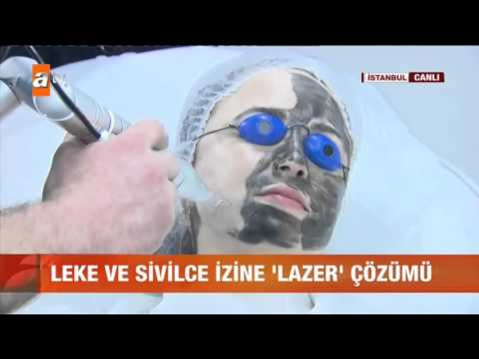 Leke ve sivilce izine lazer çözümü - atv Gün Ortası Bülteni
