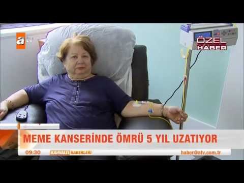 Meme kanserinde devrim gibi buluş! - atv Kahvaltı Haberleri