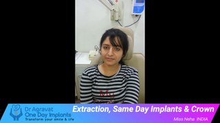 Immediate implant placement after extraction review of Dr Agravat One Day Implant Ahmedabad India