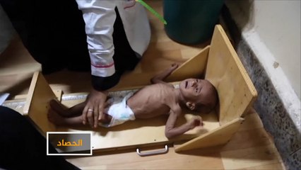 الصليب الأحمر يحذر من وضع صحي كارثي باليمن