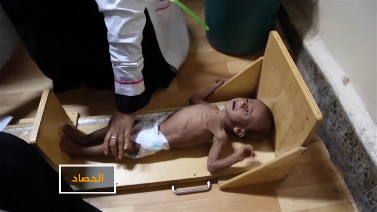 الصليب الأحمر يحذر من وضع صحي كارثي باليمن