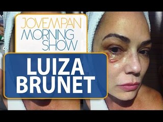 Luiza Brunet aparece com olho roxo em foto após agressão | Morning Show