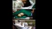 【레드서클 공포】 병원 cctv에 찍힌 소름끼치고 충격적인 영상 《한글자막》