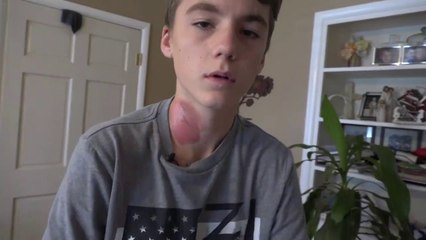 Ses amis lui versent de l'eau bouillante sur le visage alors qu'il dort.