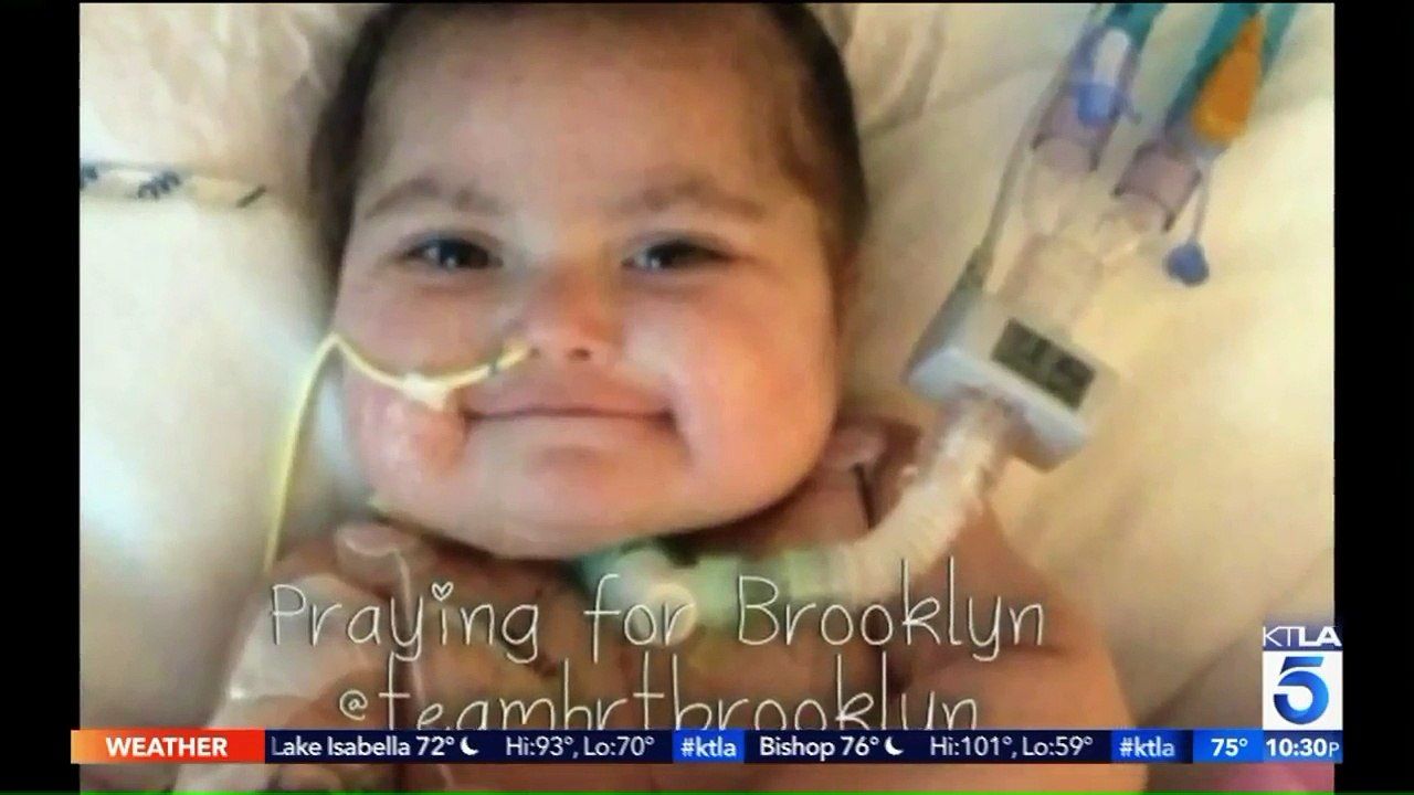 Girl Celebrates 5th Birthday After Doctors Said She Wouldn't Survive Past One