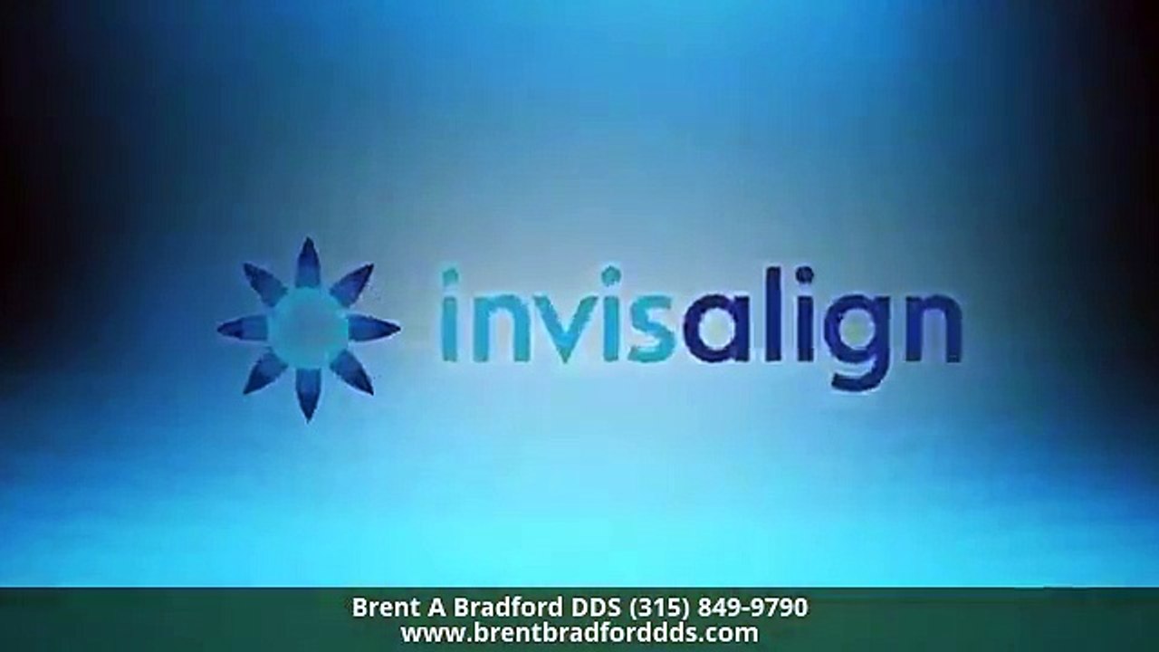 Clear Aligners Liverpool NY