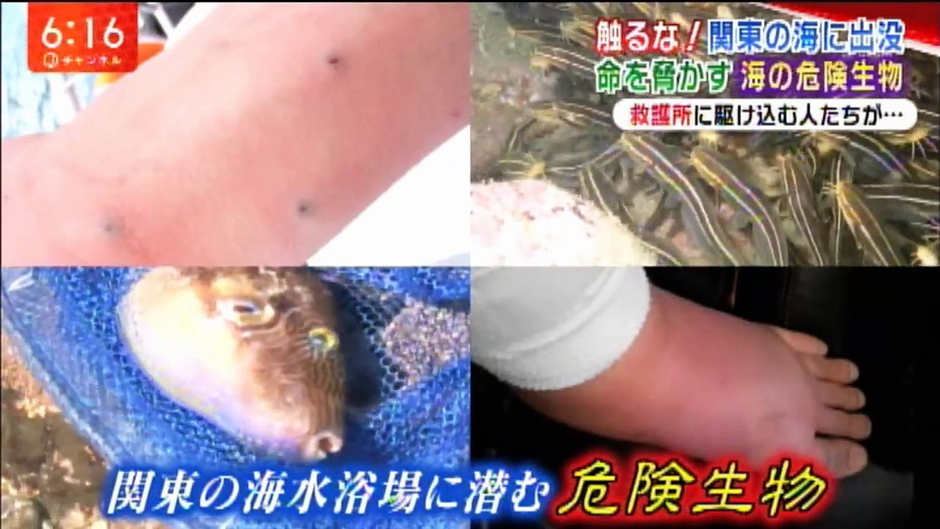 触るな 食べるな 海の 危険生物 Video Dailymotion