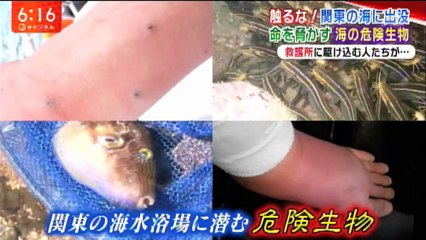 触るな！食べるな！海の〝危険生物〟