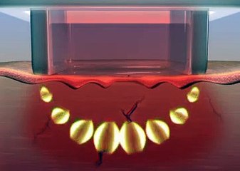 Best Treatment For Wrinkles and Skin Tightening