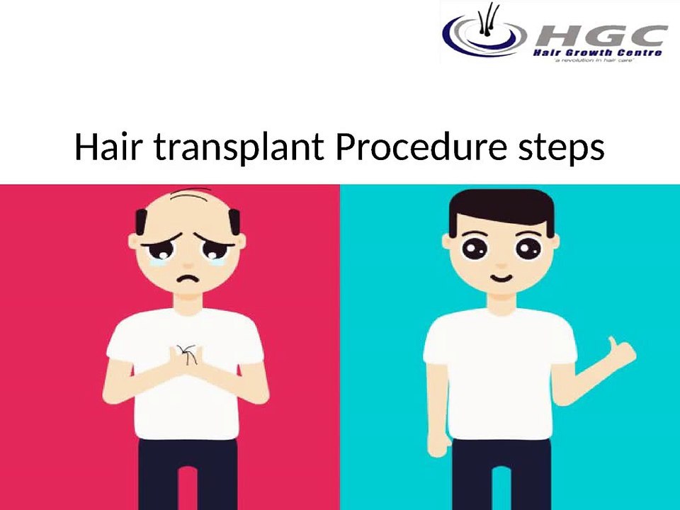 Hair_transplant_Procedure_steps