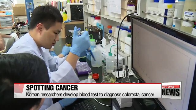 Korean researchers develop blood test to diagnose colorectal cancer
