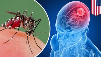 Zika virus may be key to curing deadly brain cancer