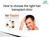 How to choose the right hair transplant clinic