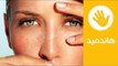 طريقة فعالة لعلاج انتفاخ العينين | وصفة طبيعية لعلاج انتفاخ العينين | هاندميد