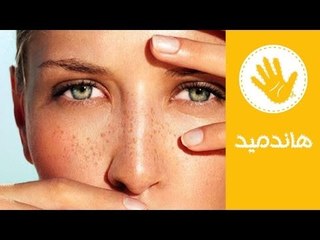 Descargar video: طريقة فعالة لعلاج انتفاخ العينين | وصفة طبيعية لعلاج انتفاخ العينين | هاندميد