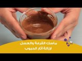 ماسك القرفة والعسل لإزالة آثار الحبوب وتوحيد لون البشرة | DIY: Honey and Cinnamon Face Mask