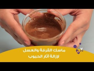 Download Video: ماسك القرفة والعسل لإزالة آثار الحبوب وتوحيد لون البشرة | DIY: Honey and Cinnamon Face Mask