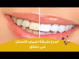 طريقة سريعة لتبيض الأسنان في دقائق | How To Whiten Teeth At Home