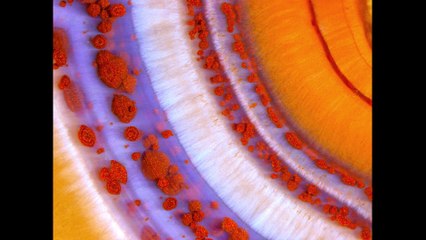 Micro Photo : Comme neige au soleil...